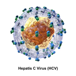 hepatitis